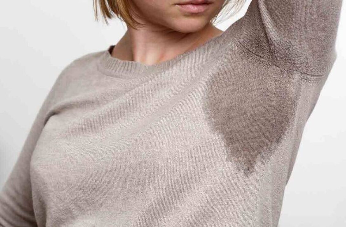  Excessive sweating can be controlled by botulin injections